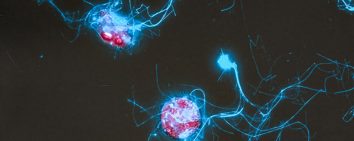 The image is a microscope view of the diatom Conticribra weissflogii (red) and the sugar structures it secretes (blue).